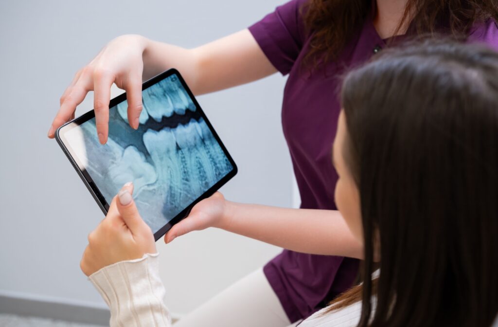 A dentist uses X-ray scans to explain why a tooth extraction is the most appropriate treatment for their patient.