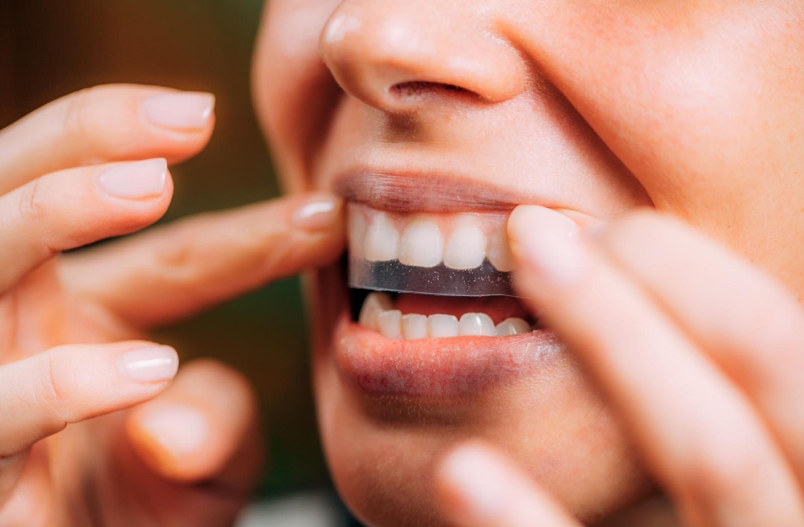 Person applying a teeth whitening strip, showing at-home whitening treatment for a brighter smile.